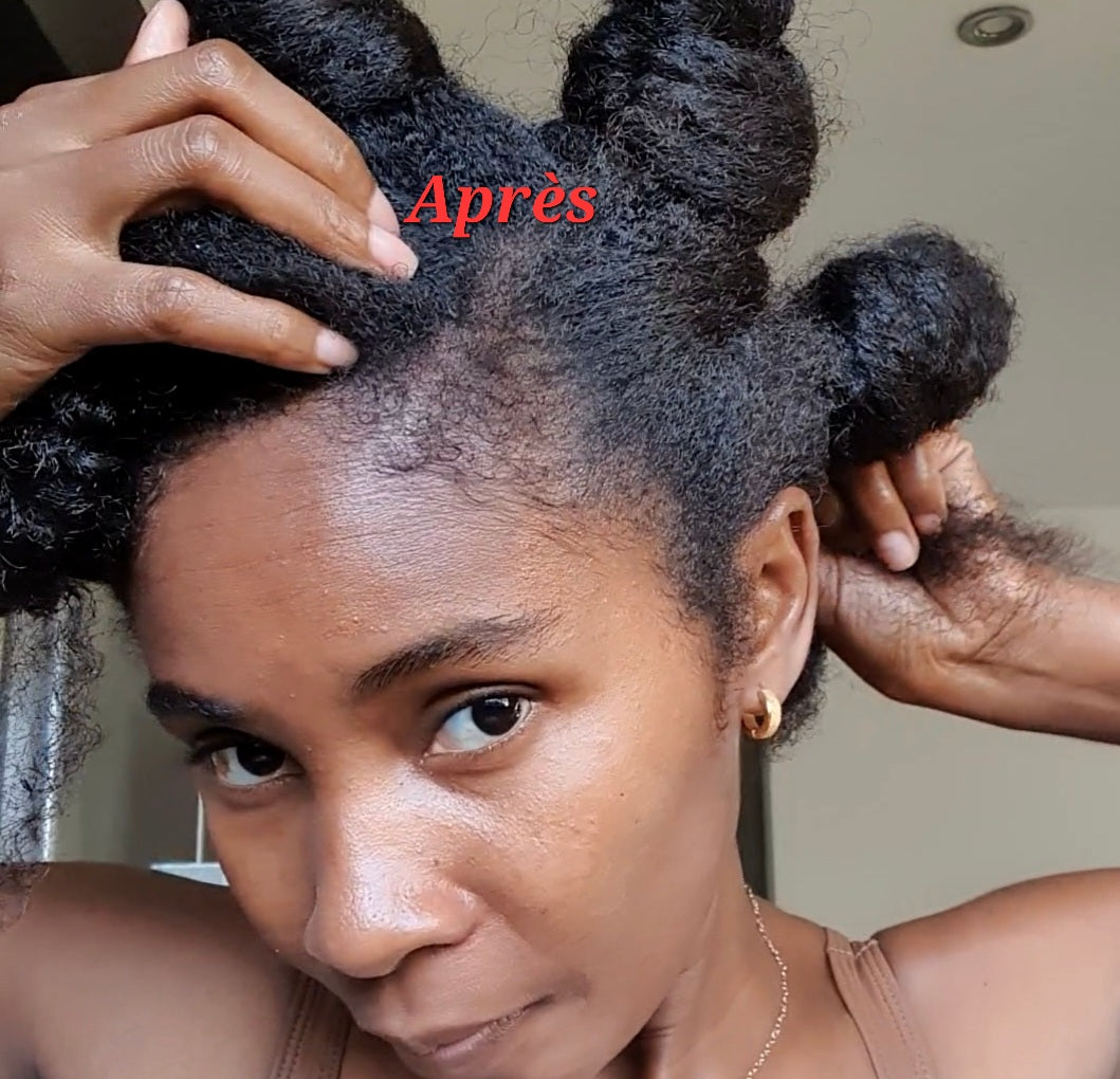 Dermaroller Stimule la pousse des cheveux